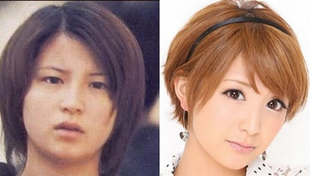 矢口真里 整形比較写真