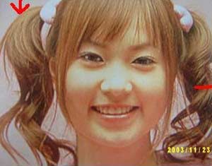 ICONIQ　整形前１