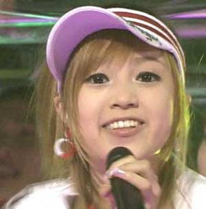 ICONIQ　整形前３