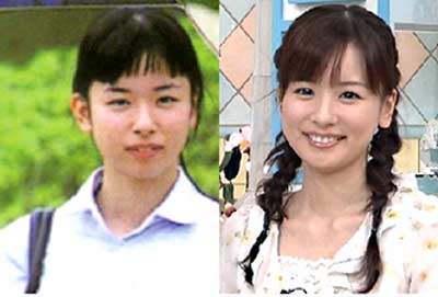 皆藤愛子　整形前後