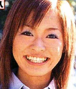 小森純　二重前2