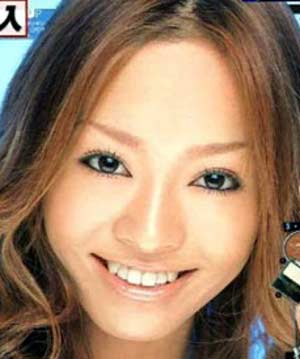 小森純　二重後1