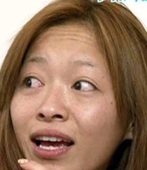 小森純　二重後2