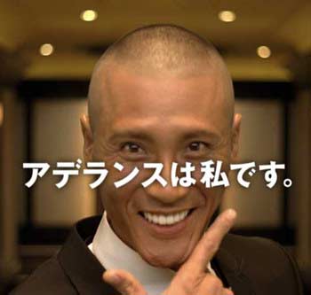 新庄剛志　アデランス　ハゲ