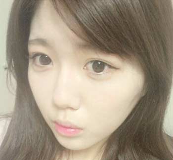 宮崎美穂 整形後1