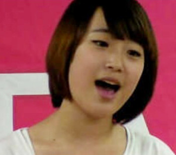 KARA　ユンジ　整形