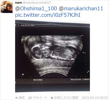 弦巻健人選手とタイ人女性不倫相手妊娠エコー