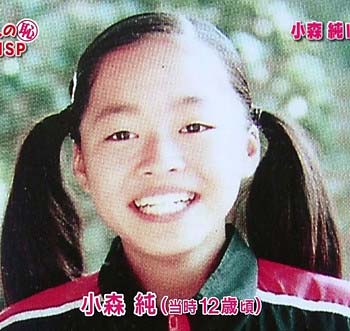 小森純が小学生の頃の写真　整形前
