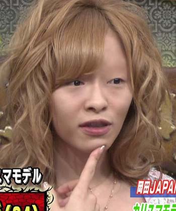 小森純すっぴん整形後