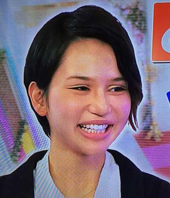 水沢アリー整形 顔黒い