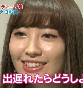 AKB48小嶋陽菜の肌荒れが激しいことが明らかに