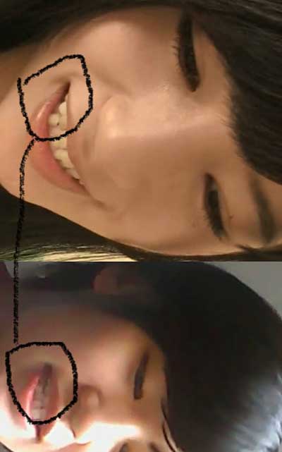 高崎聖子と動画に登場する女性の歯型