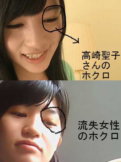 高崎聖子と流出動画に登場する女性のホクロの位置の比較