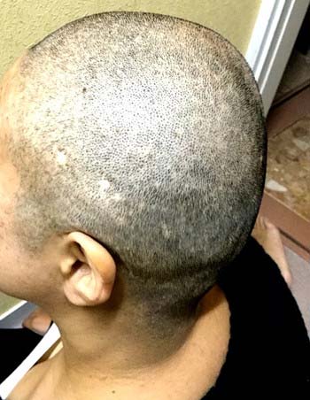 坊主にした北斗晶1枚目