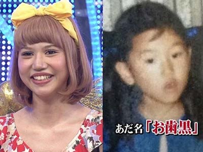 画像右が水沢アリーの幼少期