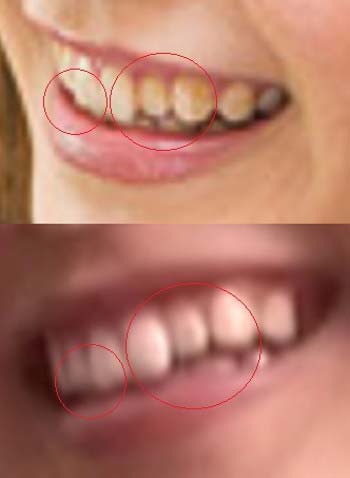 新田恵海の歯とアダルト作品に出演している女性の歯の形比較