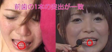 新田恵海のアダルト作品出演疑惑で歯の形検証画像