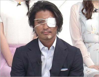 自転車で顔面を負傷したTOKIO・山口達也