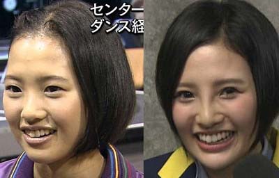 左がデビュー頃、右が整形後?の兒玉遥