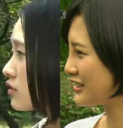 HKT48・兒玉遥の鼻の形を横から見た写真