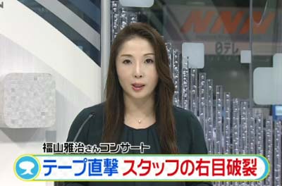 福山雅治のライブで女性スタッフが右目眼球破裂の重傷