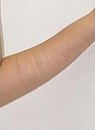 藍井エイルの左腕のアップ