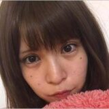 坂口杏里が美容整形しビフォーアフター公開 腕にリストカット跡 吐きダコも 画像あり 精神不安定で摂食障害 今日の最新芸能ゴシップニュースサイト 芸トピ