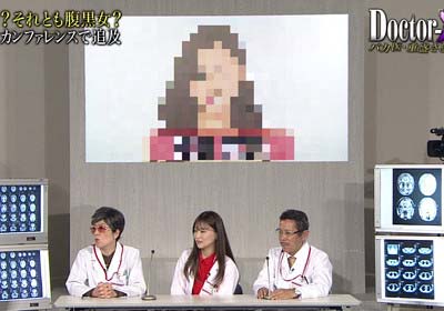 重盛さと美がめちゃイケで整形疑惑を指摘した女性芸能人のイラスト