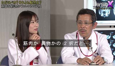 重盛さと美がめちゃイケで整形している女性芸能人の頬が固まってる、異物が入っていると暴露