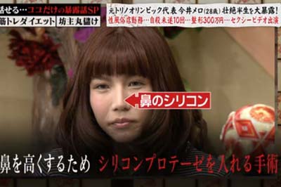 今井メロが鼻にシリコンの整形告白