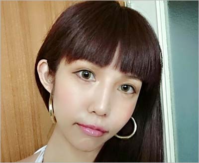 今井メロの整形後の写真