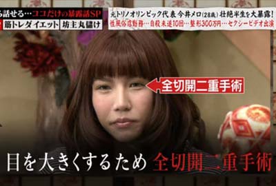 今井メロの整形告白