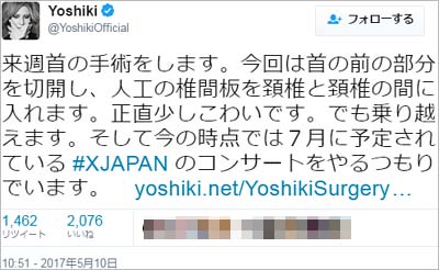 YOSHIKIのツイート