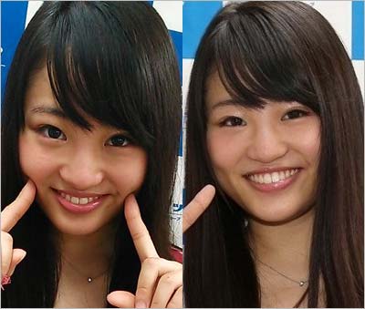 元NMB48の岡田梨紗子がグループ卒業後の整形前?の写真