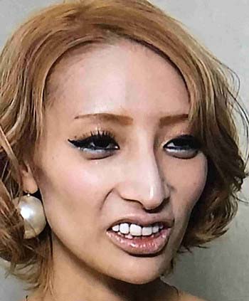 加藤紗里の現在の顔、鼻整形疑惑