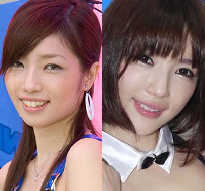 森下悠里の整形前と整形後？のビフォーアフター