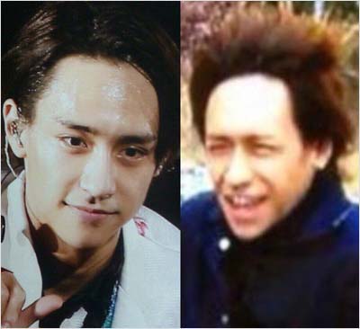 Hey! Say! JUMP八乙女光ののハゲ疑惑画像