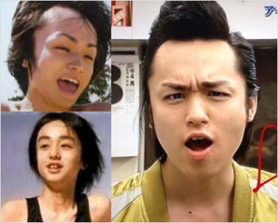 Hey! Say! JUMP伊野尾慧のハゲ疑惑画像