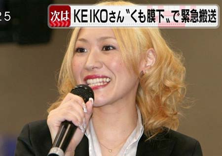 2011年10月にクモ膜下出血を発症したKEIKO