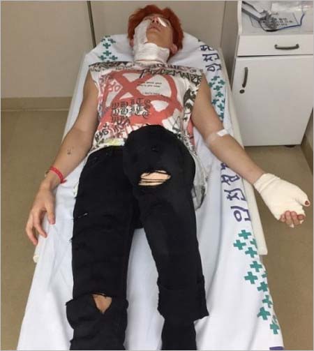 U-KISS・キソプの事故後の姿