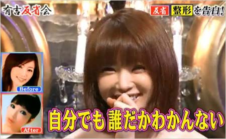 整形告白の森下悠里2枚目