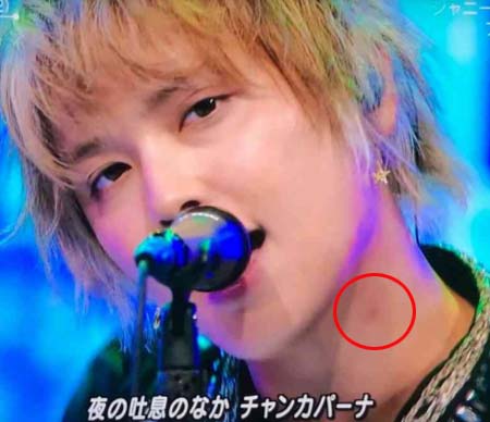 手越祐也のキスマーク疑惑