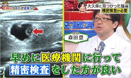 『名医のTHE太鼓判!』出演の大久保佳代子