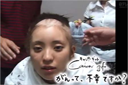 乳ガン発症し抗ガン剤治療を行い、副作用で髪の毛が抜け落ちた鈴木美穂記者