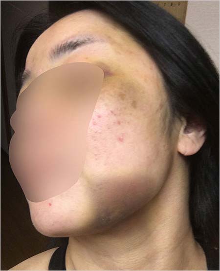 ボブ・サップの元彼女A子のDV被害、顔写真