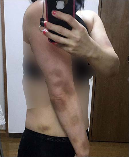 ボブ・サップの元彼女A子のDV被害