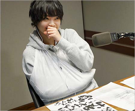 ギプスをはめた平手友梨奈