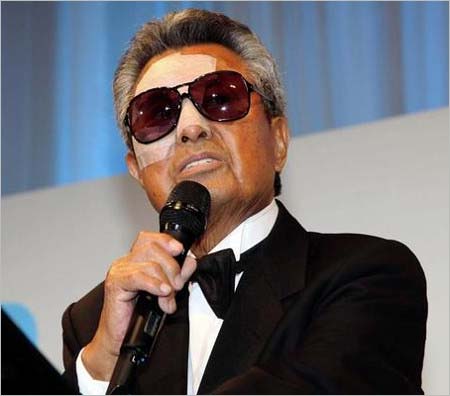 顔面を30針縫う大ケガを負った梅宮辰夫