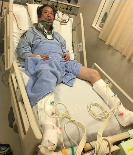 木原実が脊髄損傷(脊椎損傷)で入院