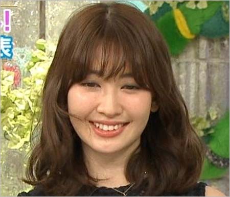 小嶋陽菜が鼻筋 アゴ美容整形疑惑 鼻高く太くなり疑いも真相は 元akb48後に顔が変わった 画像あり 今日の最新芸能ゴシップニュースサイト 芸トピ